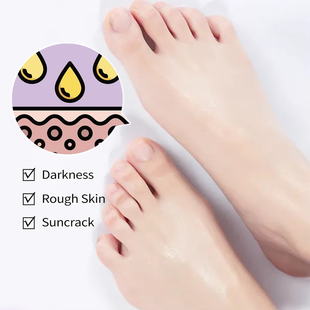 Mango Feet Anti Crack Foot Cream Feet Peel Mask Heel Cracked Dry Repair Cream Hand Peeling Removal Callus Dead Skin Feet Care